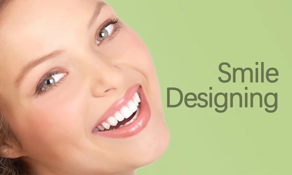 Smile Designing